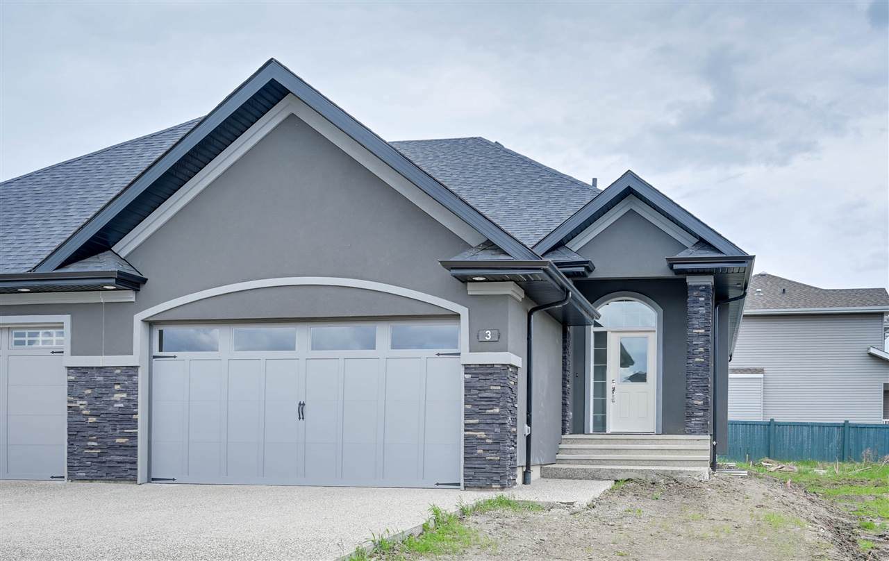 3 20425 93 Avenue - Photo 1