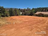 15 Alta Vista Drive - Photo 5