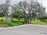 532 25th Avenue - Photo 2