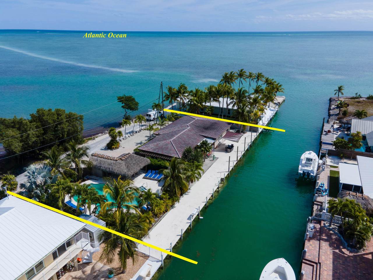 900 101St Street Ocean Street - Photo 1