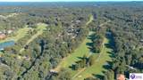 20 Doe Valley Parkway West - Photo 16