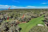 20 Turnberry Lane - Photo 82