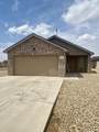 401 80th Street - Photo 1