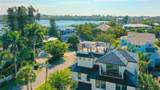307 62ND Street - Photo 2