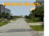 115 75th Street - Photo 2