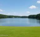 13 Abington Drive - Photo 6