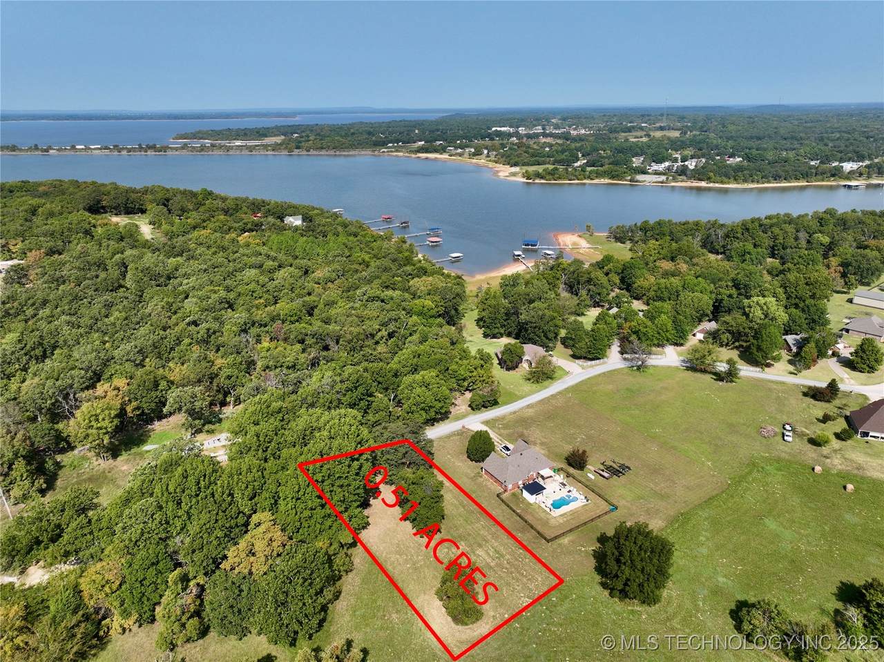 04 Meadowood - Photo 1