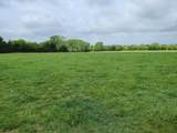  151st - Photo 1