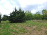 151st - Photo 4